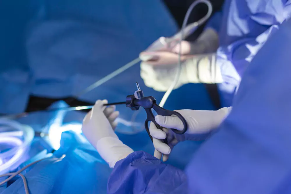 Laparoscopic (Minimally Invasive) Surgeries